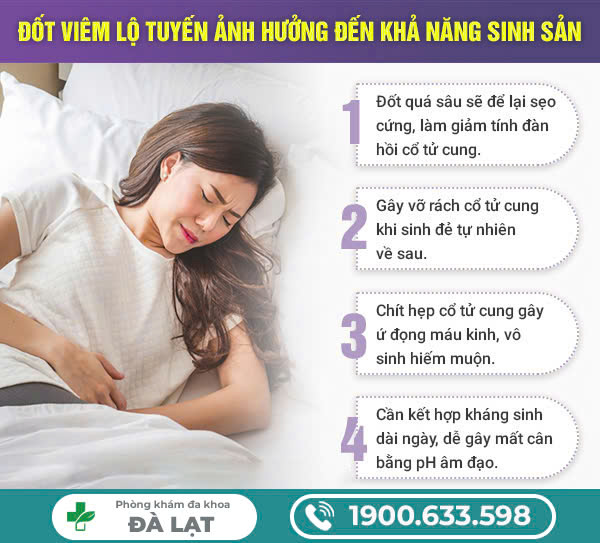 Hình ảnh minh họa